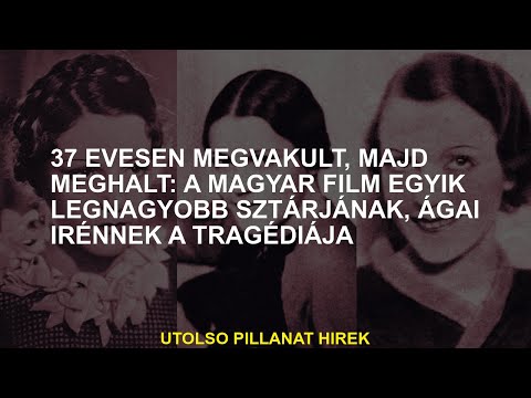 37 éves korában elvakult és később meghalt: a magyar film egyik legnagyobb csillagának, Irene Bágai
