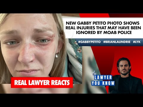 Real Lawyer Reacts: New #GabbyPetito Photo Shows Injuries That May Have Been Ignored By Moab Police